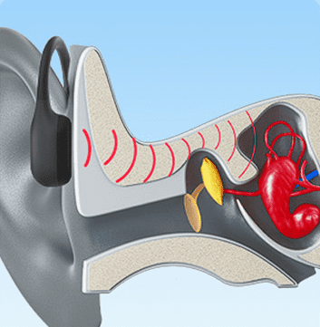 Como o som passa por condução óssea