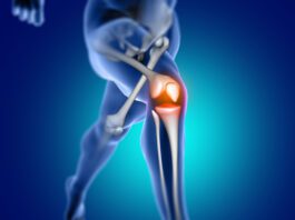 Lesões de joelho são mais propensas a ocorrer em determinados esportes