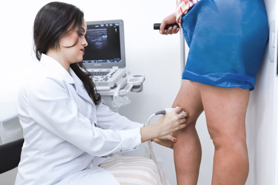 Médica explica uso do Endolaser para tratar veia safena Médica explica uso do Endolaser para tratar veia safena