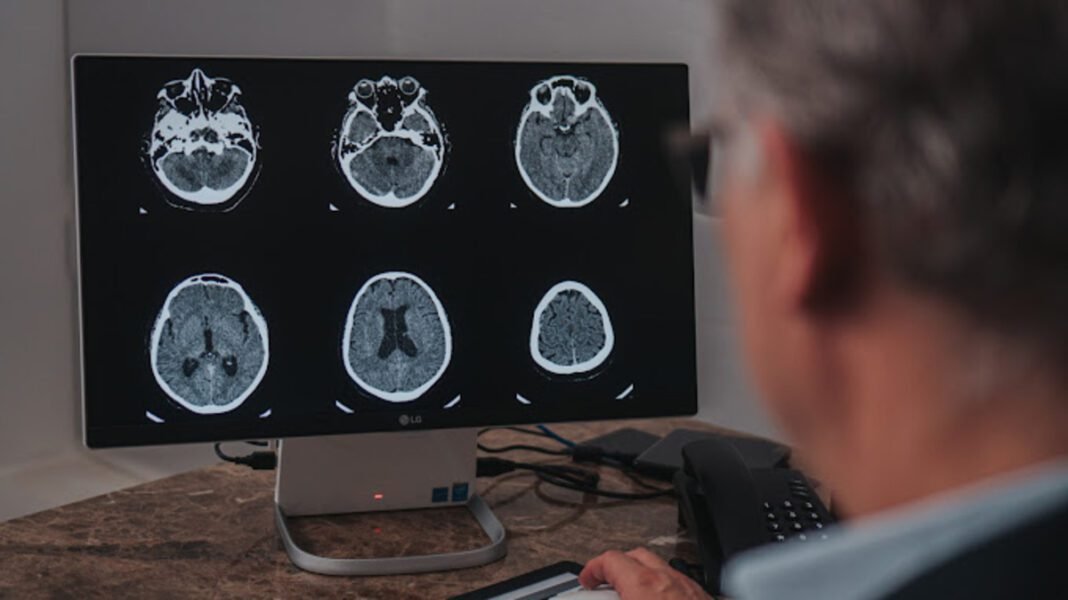 Maio Cinza: mês reforça a conscientização sobre o câncer cerebral Maio Cinza: mês reforça a conscientização sobre o câncer cerebral