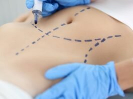 Cirurgia plástica: busca por resultado natural é tendência