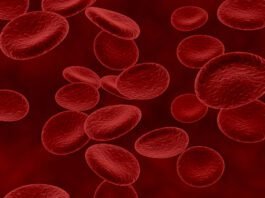 Mielodisplasia: doença silenciosa pode evoluir para leucemia