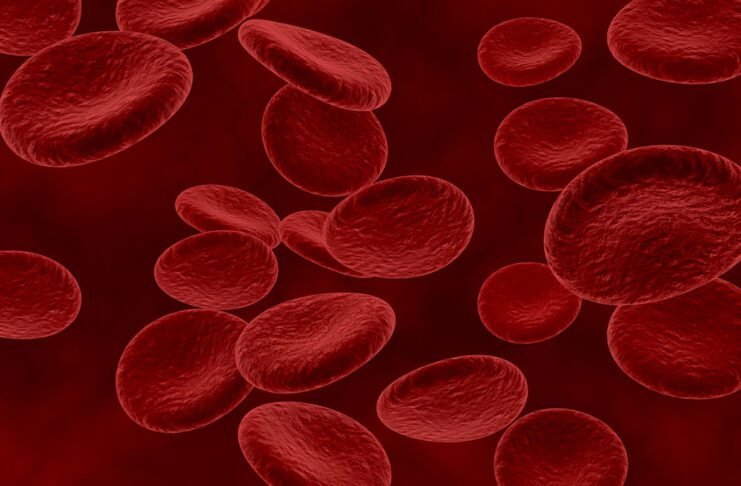 Mielodisplasia: doença silenciosa pode evoluir para leucemia