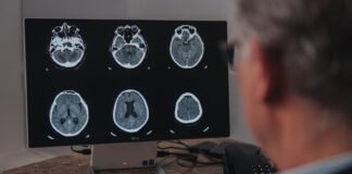 Setembro é o mês de conscientização do aneurisma cerebral