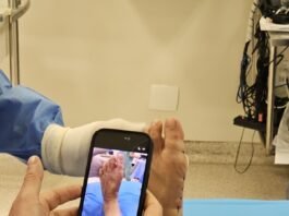 Tratamento das joanetes avança com cirurgia pouco invasiva