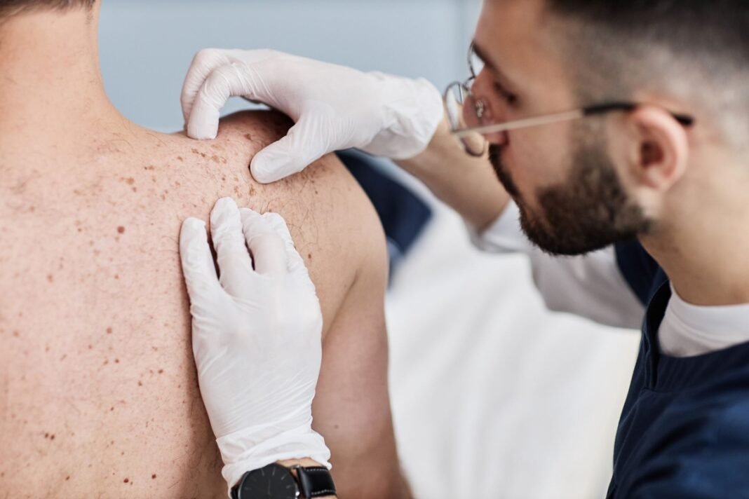 Desinformação e estigmas sobre a hanseníase atrasam cuidados Desinformação e estigmas sobre a hanseníase atrasam cuidados