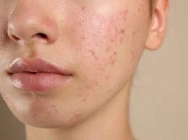 Especialista explica os efeitos do chocolate no organismo