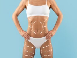 Avanços tecnológicos ampliam resultados da lipoaspiração