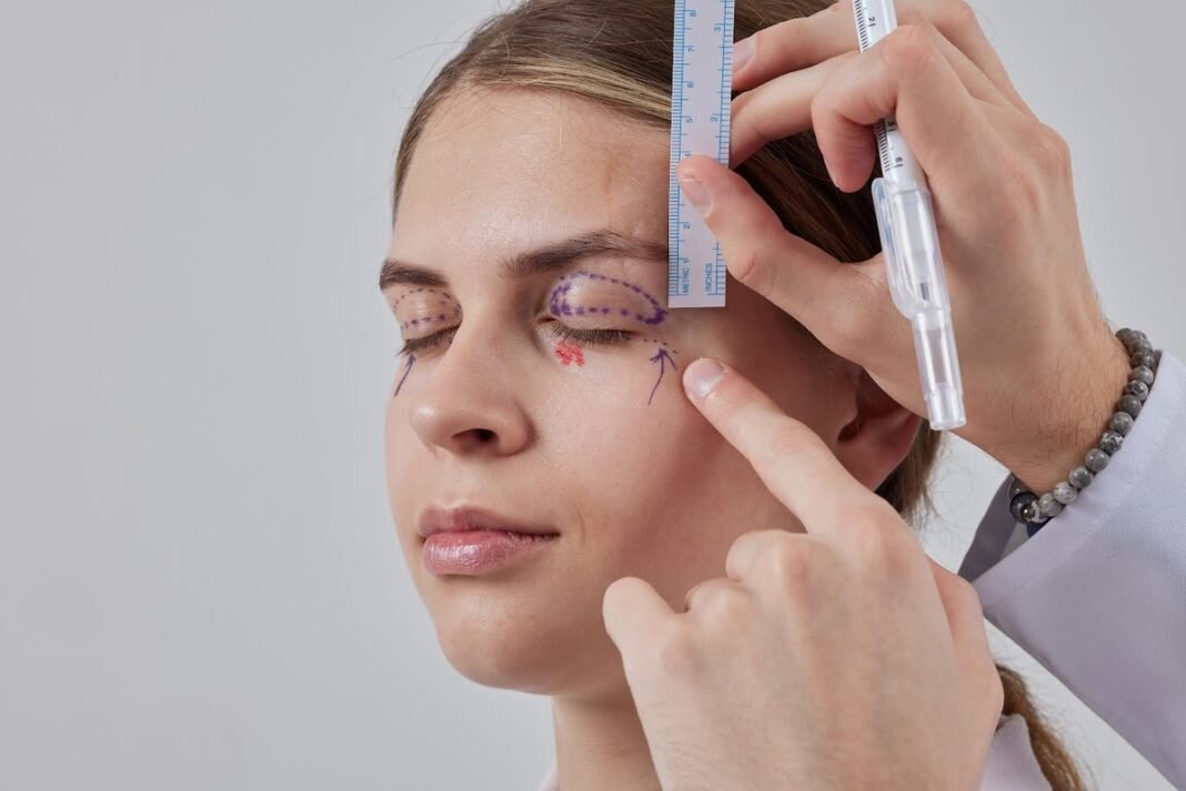 Blefaroplastia exige avaliação pré-cirúrgica individualizada Blefaroplastia exige avaliação pré-cirúrgica individualizada