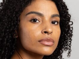 Mês de Conscientização da Acne incentiva cuidados especiais