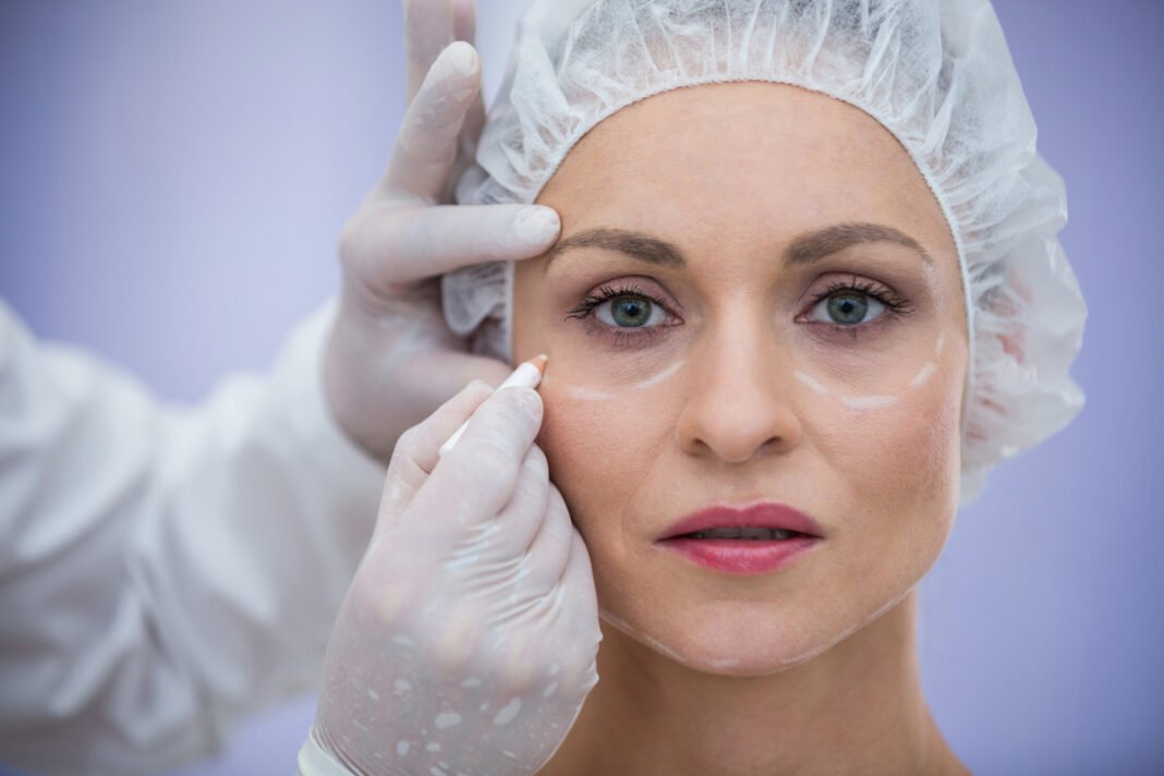 Cirurgia das pálpebras melhora aparência e visão Cirurgia das pálpebras melhora aparência e visão