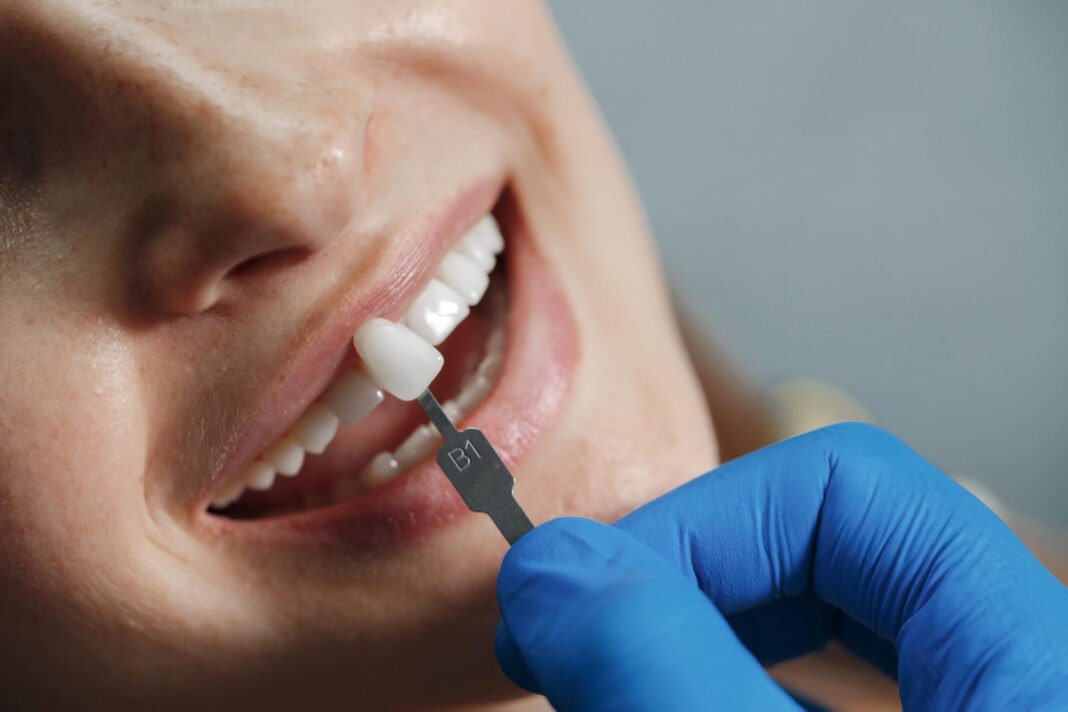 Falha em tratamento dentário nem sempre indica erro Falha em tratamento dentário nem sempre indica erro