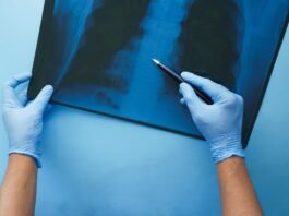 CONITEC abre consulta para Hipertensão Arterial Pulmonar