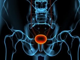 Urologista explica diferenças entre HPB e câncer de próstata