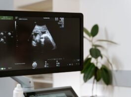 Vilo corial tem diagnóstico genético precoce